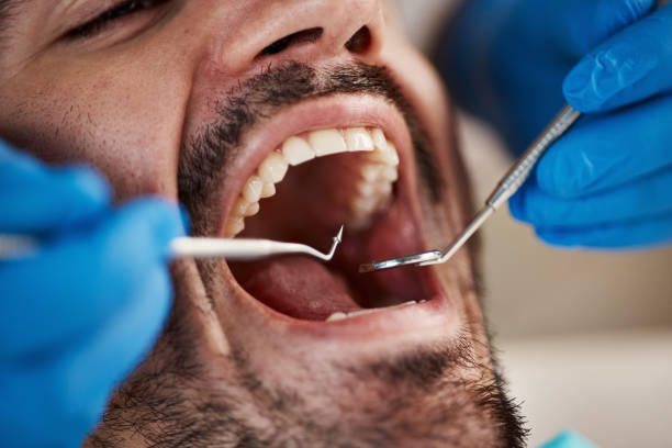 Best Emergency Dentist for Knocked-Out Tooth in Pleasant Hill, IA